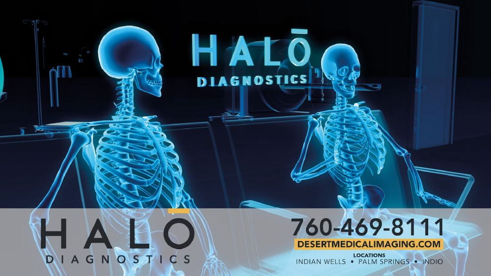 Halo Diagnostic